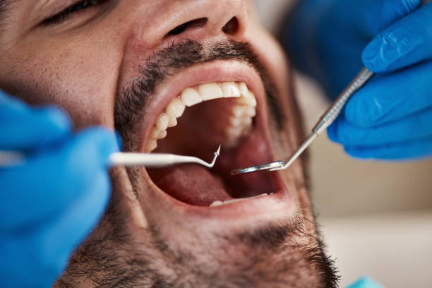Best Emergency Dental Care for Broken or Chipped Teeth in Brownwood, TX